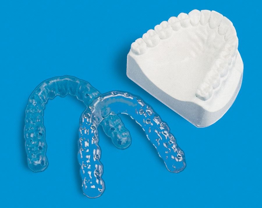 Parodontalbehandlung